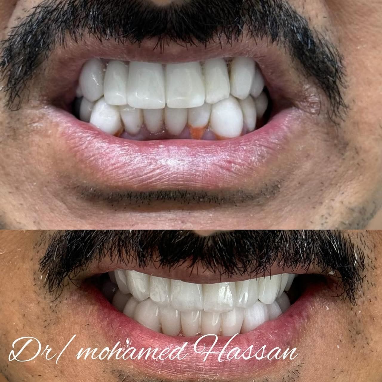 فريق Go Smile Dental الطبي